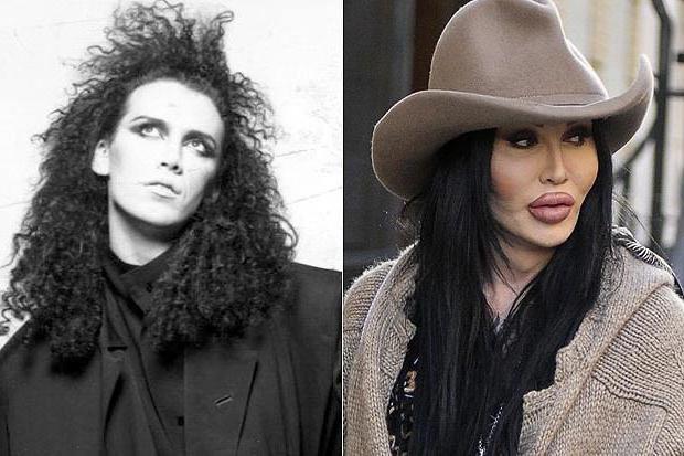 Pete Burns fotografija