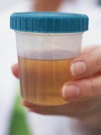 proteina u urinu djeteta uzrokuje
