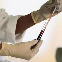 Norma test krvi, što je njegovo značenje