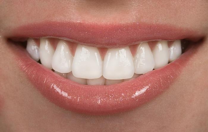 Moderni furniri na zubima: što je to?